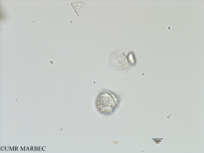 phyto/Bizerte/bizerte_bay/RISCO November 2015/Gonyaulax polygramma (ancien Dino 32 -Baie_T5-C3-Gonyaulax plus petit-1).tif(copy)_thumb.jpg